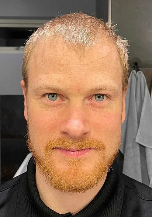 Niels’ before photograph, supplied by Scandinavian Biolabs